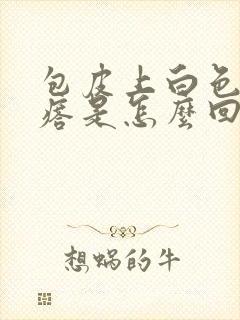 包皮上白色小疙瘩是怎么回事