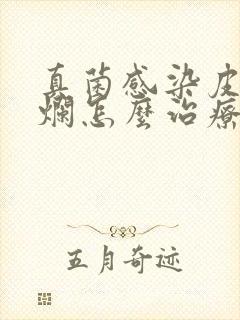 真菌感染皮肤溃烂怎么治疗