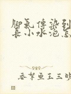 脚气传染到手上长小水泡怎么治疗封面