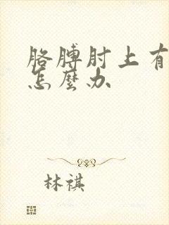 胳膊肘上有块癣怎么办