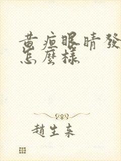 黄疸眼睛发黄是怎么样