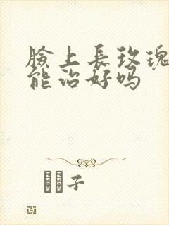 脸上长玫瑰痤疮能治好吗