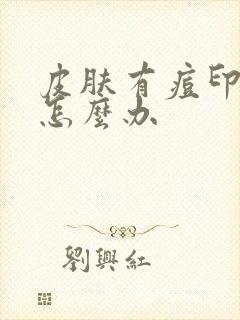 皮肤有痘印痘坑怎么办