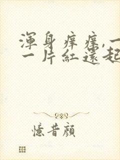 浑身痒痒,一挠一片红还起白疙瘩