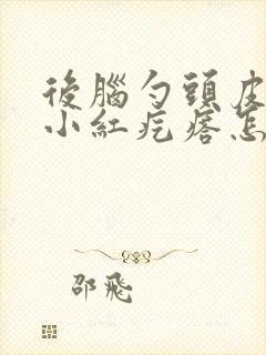 后脑勺头皮上长小红疙瘩怎么回事