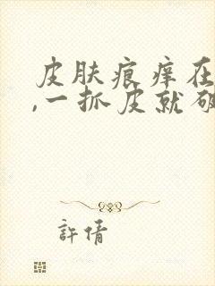 皮肤痕痒在手指,一抓皮就破出血,应怎样治