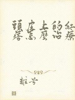 头皮上的红色疙瘩怎么治疗