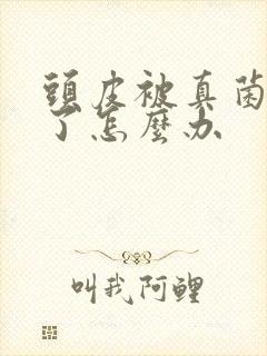 头皮被真菌感染了怎么办