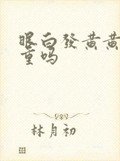 眼白发黄黄疸严重吗