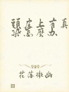 头皮上有真菌感染怎么办