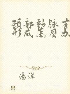 颈部动脉有斑块形成怎么办