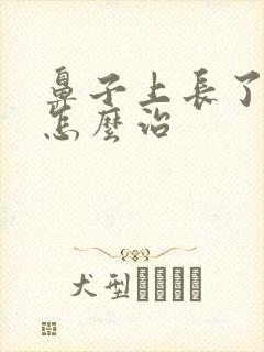 鼻子上长了痤疮怎么治