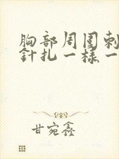 胸部周围刺痛像针扎一样一阵一阵的