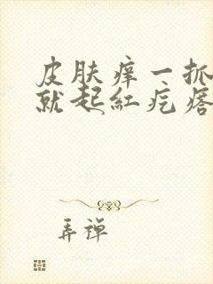 皮肤痒一抓就红就起红疙瘩