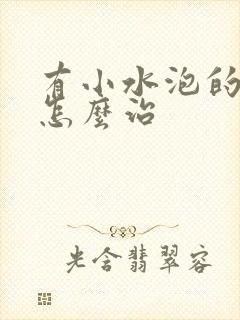 有小水泡的脚气怎么治