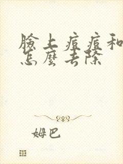 脸上痘痘和痘印怎么去除