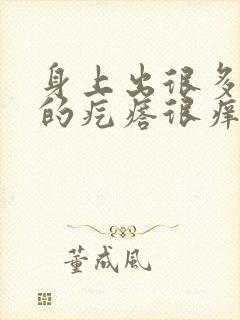 身上出很多红色的疙瘩很痒是怎么了