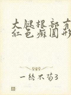 大腿根部有一块红色癣圆形的封面