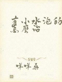 有小水泡的脚气怎么治