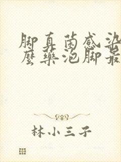 脚真菌感染用什么药泡脚最好