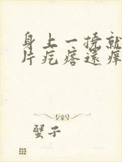 身上一挠就起一片疙瘩还痒怎么办