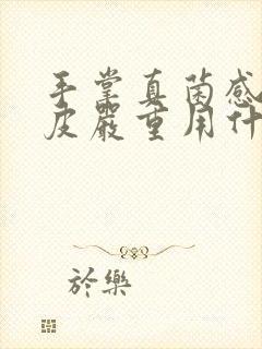 手掌真菌感染脱皮严重用什么药最好