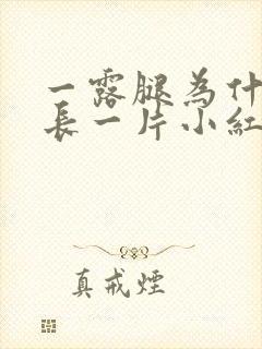 一露腿为什么就长一片小红疙瘩