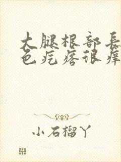 大腿根部长了红色疙瘩很痒封面