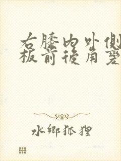 右膝内外侧半月板前后角变性损伤