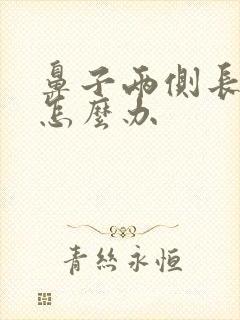 鼻子两侧长痤疮怎么办