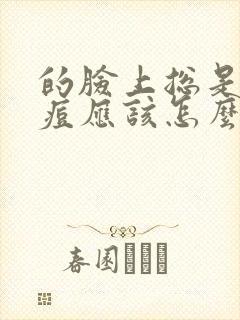 的脸上总是长痘痘应该怎么办