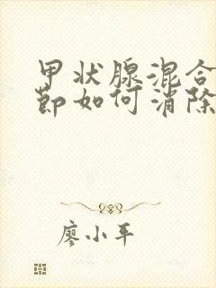 甲状腺混合性结节如何消除