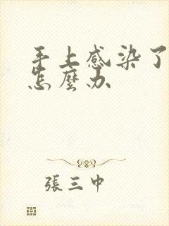 手上感染了真菌怎么办封面