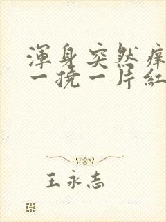 浑身突然痒痒,一挠一片红还起疙瘩