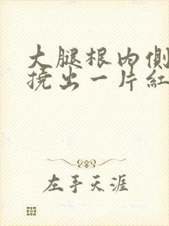 大腿根内侧发痒挠出一片红疙瘩