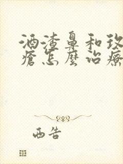 酒渣鼻和玫瑰痤疮怎么治疗