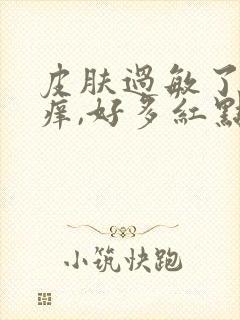 皮肤过敏了有点痒,好多红点点