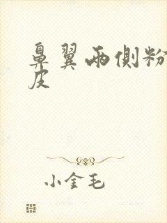 鼻翼两侧粉刺脱皮