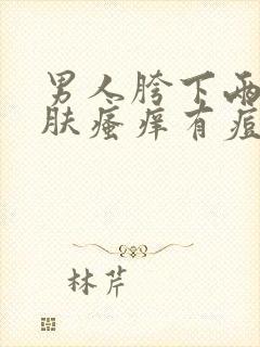 男人胯下两侧皮肤瘙痒有痘痘