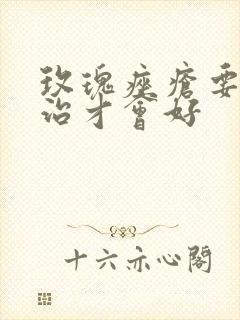 玫瑰痤疮要怎么治才会好