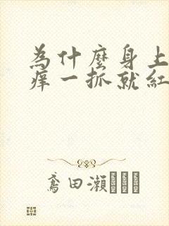 为什么身上老是痒一抓就红