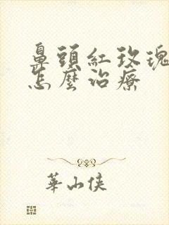 鼻头红玫瑰痤疮怎么治疗