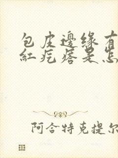 包皮边缘有一排红疙瘩是怎么回事