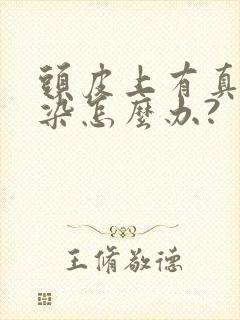 头皮上有真菌感染怎么办?