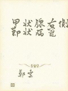 甲状腺右侧叶结节状病灶