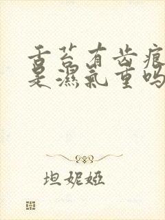 舌苔有齿痕一定是湿气重吗