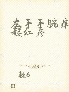 左手手腕痒一挠起红疹