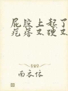 屁股上起了个大疙瘩又硬又疼