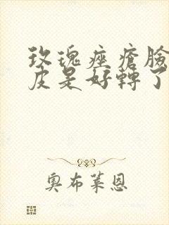 玫瑰痤疮脸上起皮是好转了吗