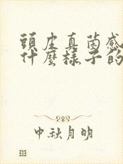 头皮真菌感染是什么样子的封面